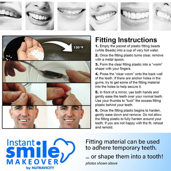 16 Packs of Instant Smile Fitting Beads & Case - Picture 2 of 5
